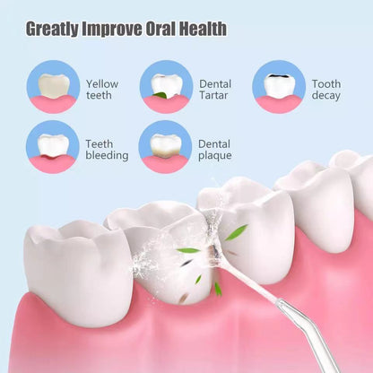 AquaJet Dental Irrigator Improve Dental Health